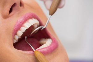 טיפולי שיניים ברומניה