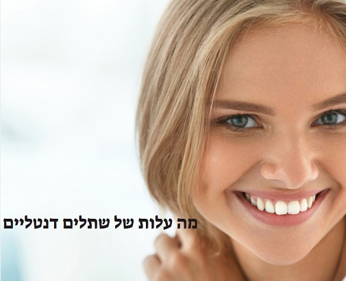מה עלות של שתלים דנטליים