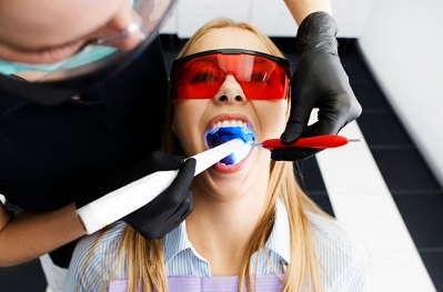 משחת שיניים להלבנת שיניים בלייזר - אלטרנטיבה פופולרית