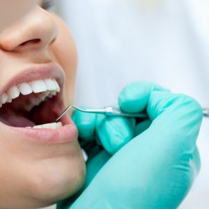 כיצד לבצע השתלות שיניים בכל הפה בהרדמה מלאה